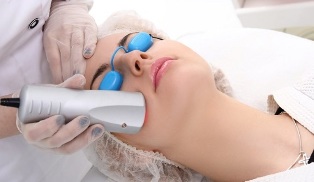 laser rejuvenation of facial skin