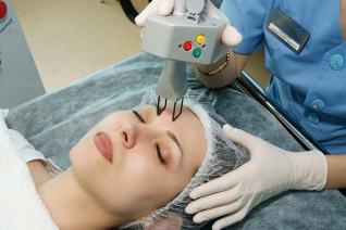 Laser fractional rejuvenation of facial skin