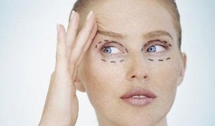 types of blepharoplasty to rejuvenate the skin around the eyes